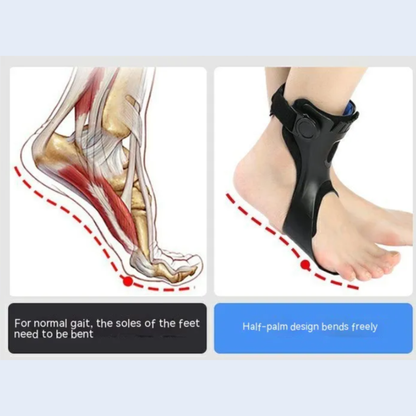 StepAlign Orthotics